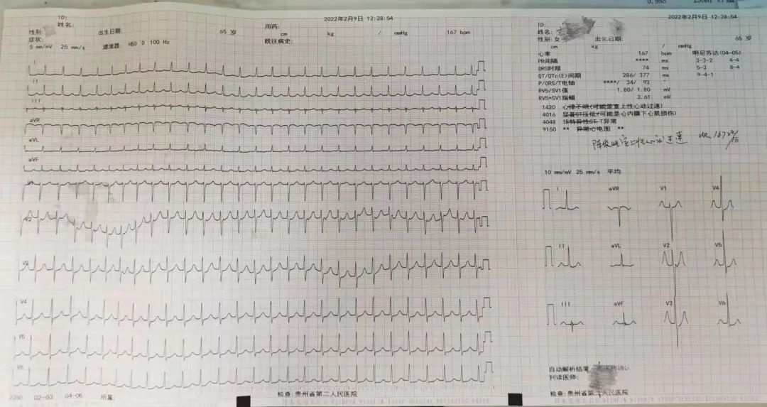 一肖一码一中一特准确资料解释落实的重要性与实际应用